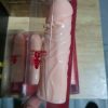 BAO CAO SU ĐÔN DÊN  ĐẦU TRƠN DA NGƯỜI